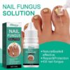 Nail fungus solution