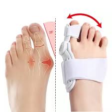 Bunion Corrector - Image 3